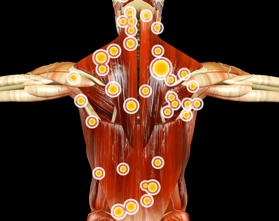 tecar - uvolnenie spazmov